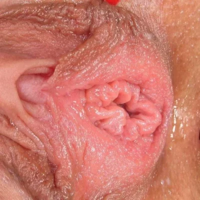 Влагалища крупным планом