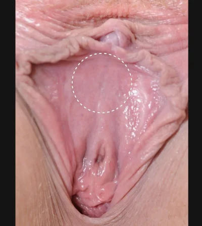 Женская вагина внутри