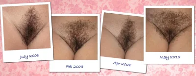 Волос на лобке