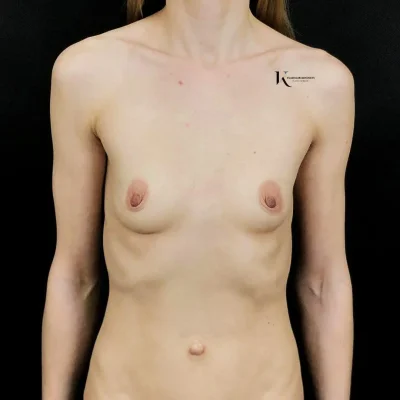 Грудь нулевого размера голая