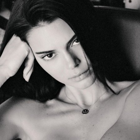 Kendall Jenner before surgery