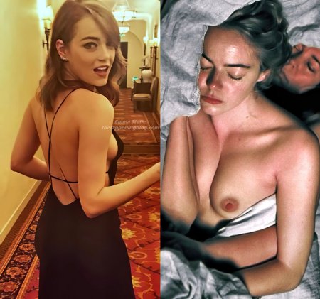 Emma Stone leaked