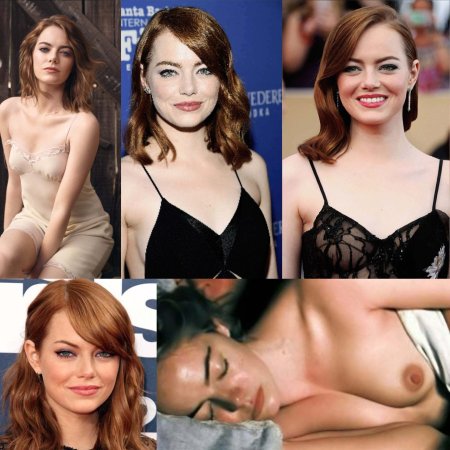 Emma Stone is hotter