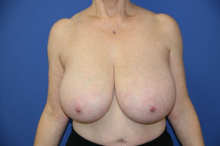 Big natural tits