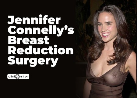 Jennifer connelly breast reduction