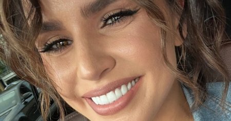 Sievert smile